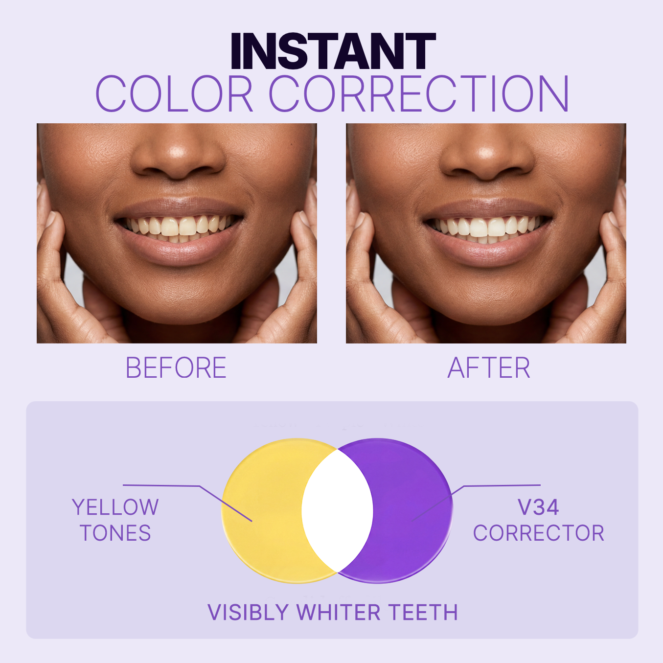 V34 Purple Whitening Strips