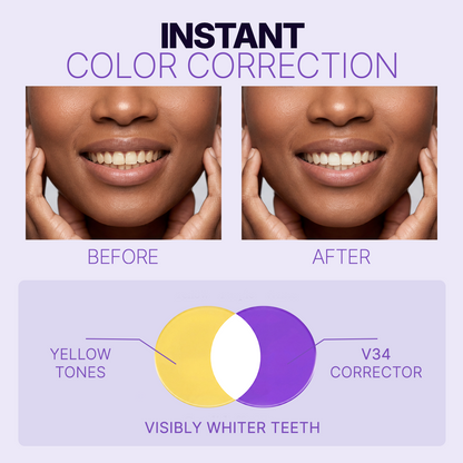V34 Purple Whitening Strips